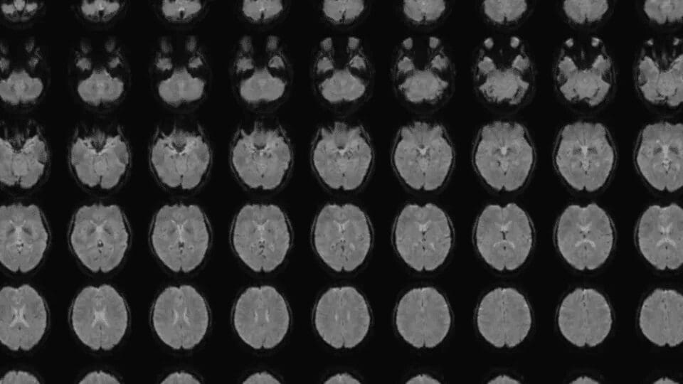 Científico japonés desarrolla técnica para convertir imágenes mentales en texto mediante IA