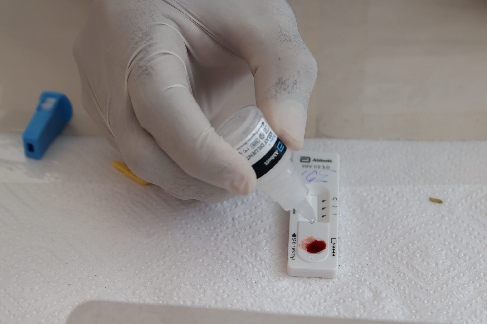 Remisión del VIH tras trasplante de células madre permite a paciente dejar tratamiento. Conoce los detalles del estudio científico.