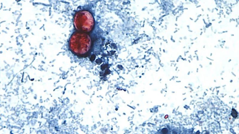 Michigan confirmó dos muertes relacionadas con el brote de ciclosporiasis; ambas víctimas padecían enfermedades preexistentes.